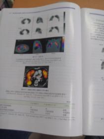 临床核医学进展：SPECT-CT与PET-CT技术与应用