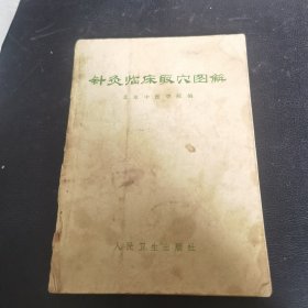 针灸临床取穴图解
