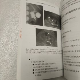 泌尿生殖系统影像学：疾病、症状的诊断与鉴别诊断