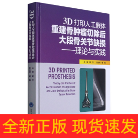 3D打印人工假体重建骨肿瘤切除后大段骨关节缺损——理论与实践