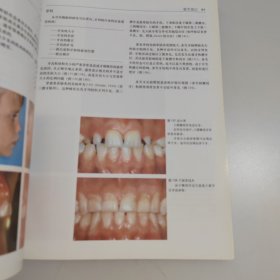 口腔正畸诊断彩色图谱