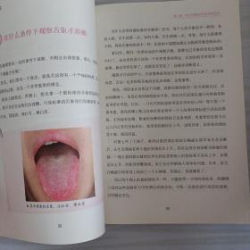 图解舌诊