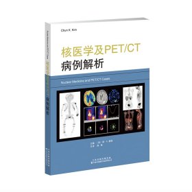 全新正版核医学及PET/CT病例解析9787543339507