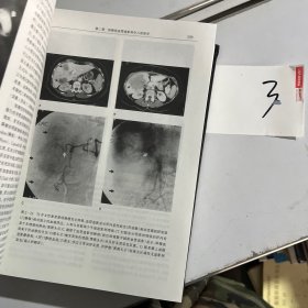 世界医学经典名著译丛：梅氏腹部外科手术学（第10版）（上卷）