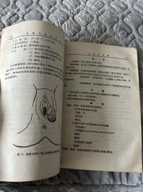 妇科疾病诊断学