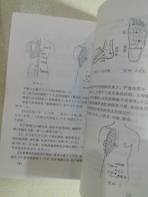 五行磁吸针磁疗针灸学