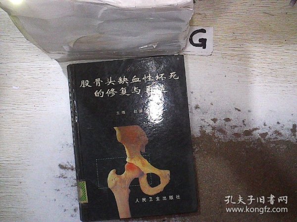 股骨头缺血性坏死的修复与再造