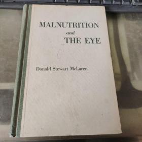 MALNUTRITION AND THE EYE 精 英文