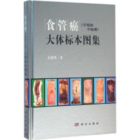 食管癌（早期和中晚期）大體標(biāo)本圖集