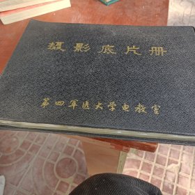 摄影底片册，肝炎，肝硬化，肝癌