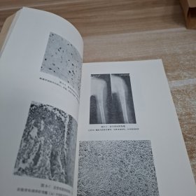 临床骨科学 肿瘤3