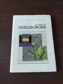 An Atlas of Osteoporosis (The Encyclopedia of Visual Medicine Series)（英文原版）