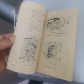 针灸治疗手册〈带毛主席语录〉70年，一版一印