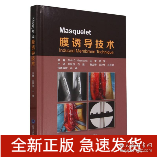 Masquelet 膜诱导技术