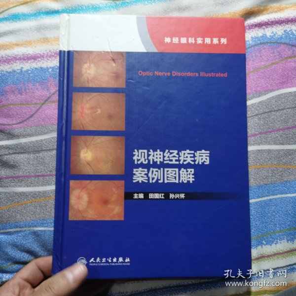 视神经疾病案例图解（神经眼科实用系列）