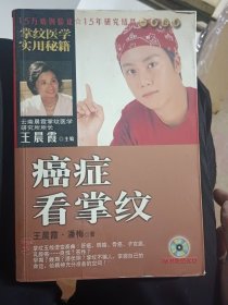 癌癥看掌紋