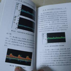 脑血管病临床手册系列·经颅多普勒超声诊断手册