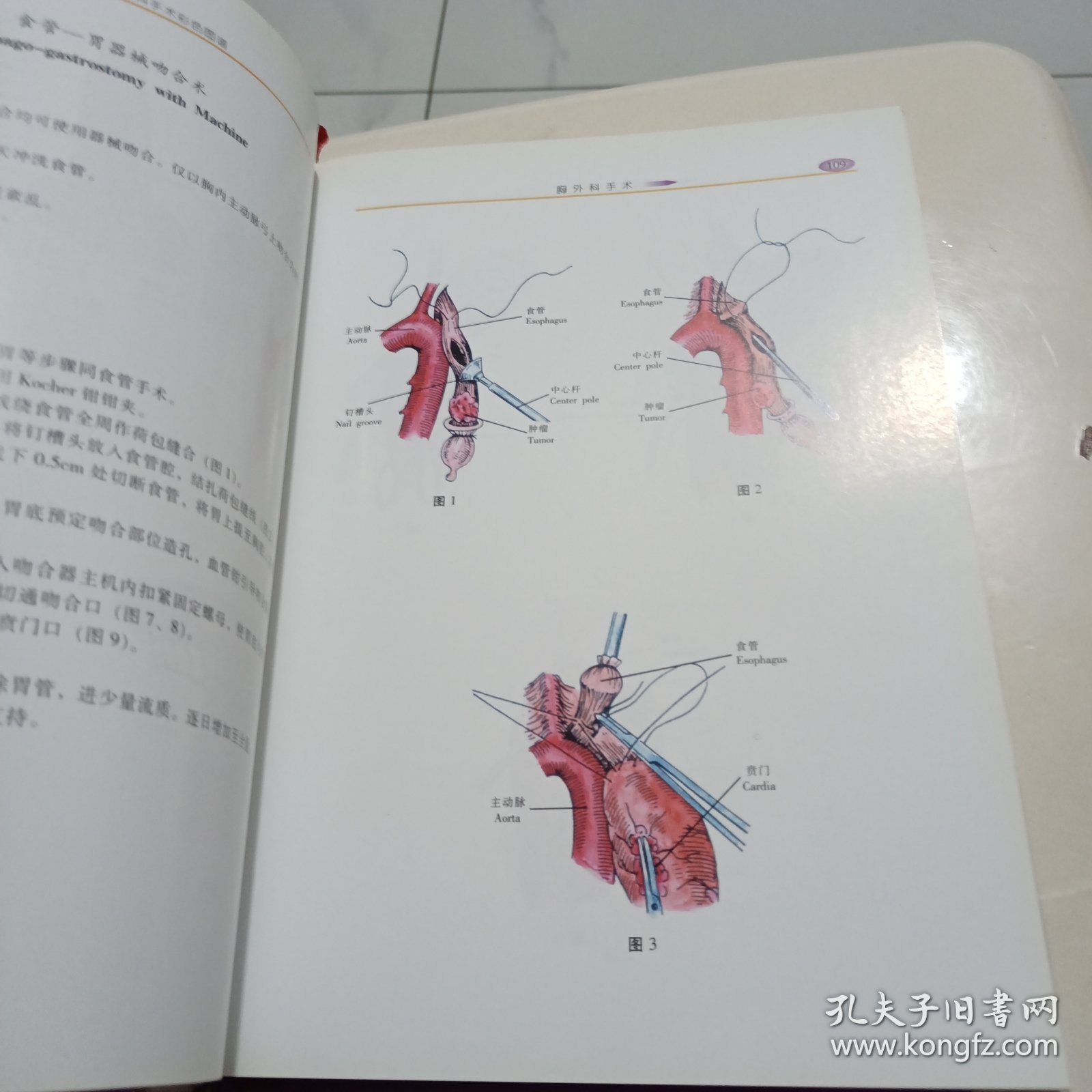 实用胸心外科手术彩色图谱——实用手术彩色图谱系列丛书