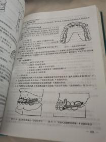 口腔正畸治疗学