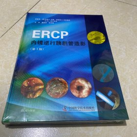 ERCP内镜逆行胰胆管造影