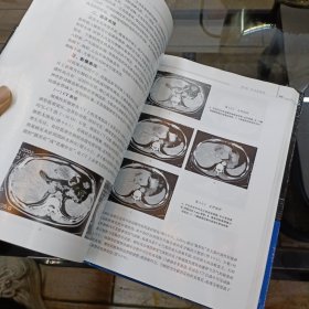 肝胆疾病影像学 作者签名本