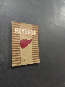 肝脏断面解剖学