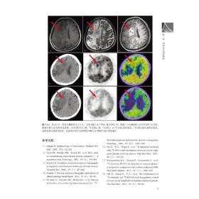 全新 核医学病例图谱——肿瘤分册