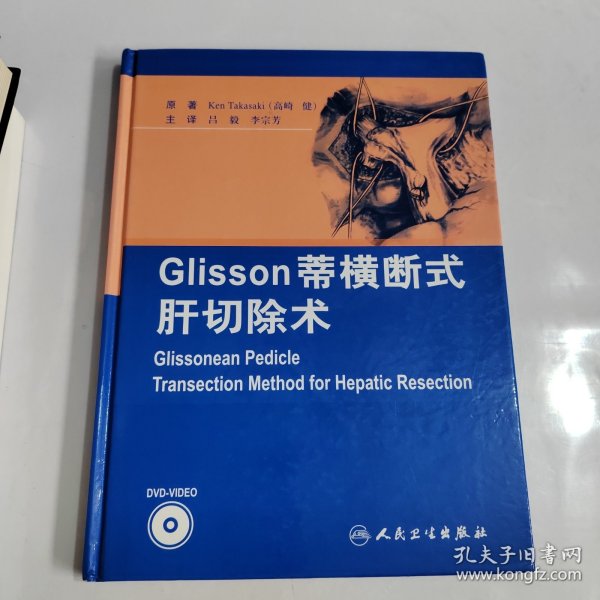 Glisson蒂横断式肝切除术