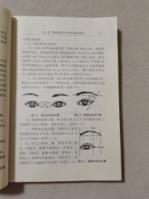 美容外科手术并发症原因分析及防治