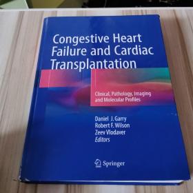 Congestive Heart Failure and Cardiac Transplantation