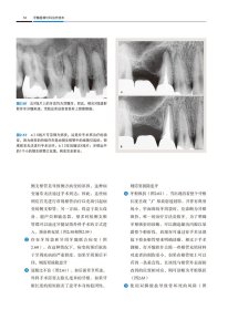 牙髓显微外科治疗技术 （意）阿纳尔多·卡斯泰卢奇（Arnaldo Castellucci）主编 阙克华，屈铁军主译 正版图书