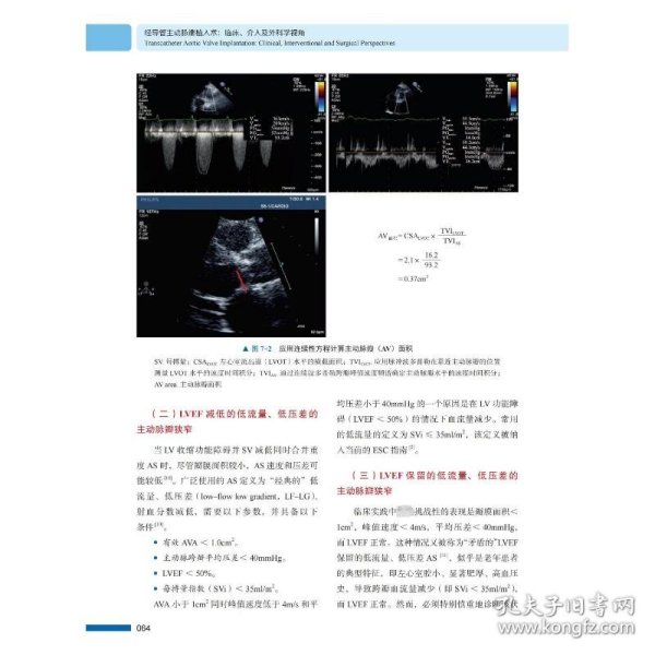 经导管主动脉瓣植入术：临床、介入及外科学视角