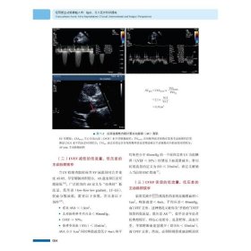 经导管主动脉瓣植入术：临床、介入及外科学视角