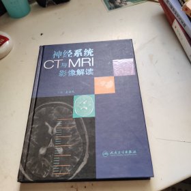 神经系统CT与MRI影像解读