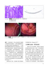 胃与肠：希望大家了解的十二指肠病变