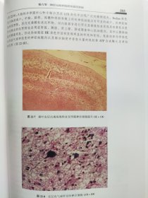 精装 现代神经内科学 李大年 原箱