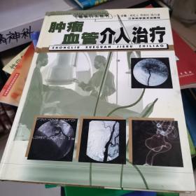 肿瘤血管介入治疗