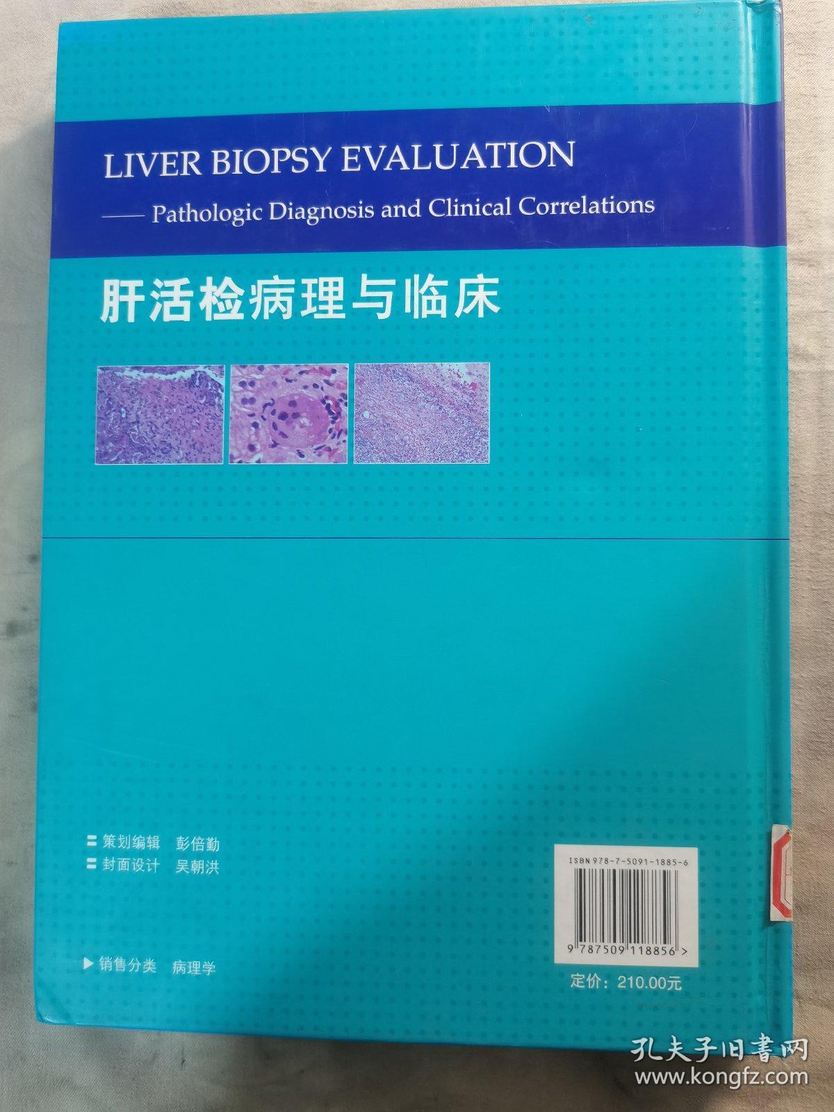 肝活检病理与临床