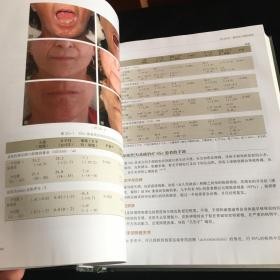 科尔曼脂肪注射：从填充到再生