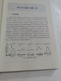 心内科疑难病例荟萃