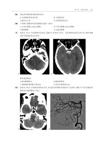 神经影像学：核心复习