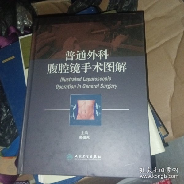 普通外科腹腔镜手术图解