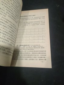 心律失常防治150问