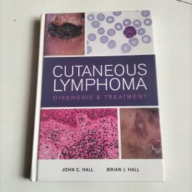 Cutaneous Lymphoma: Diagnosis and Treatment皮肤淋巴瘤：诊断与治疗，英文原版