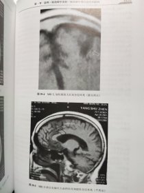 精装 现代神经内科学 李大年 原箱