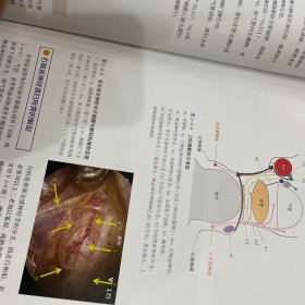 腹腔镜外科局部解剖图谱解剖路径与手术操作。