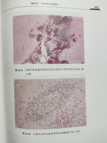 精装 现代神经内科学 李大年 原箱