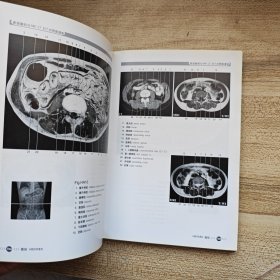 断面解剖与MRI CT ECT对照图谱2