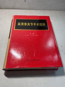 实用骨关节手术图解   一版一印