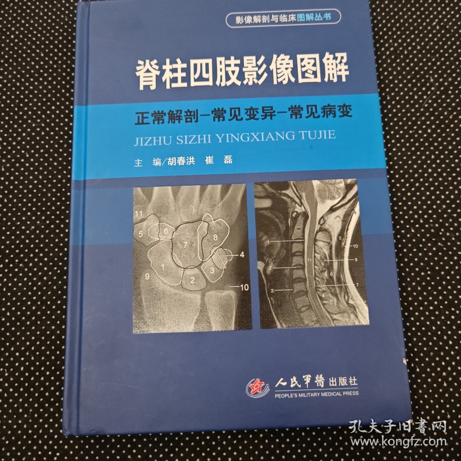 脊柱四肢影像图解：正常解剖-常见变异-常见病变